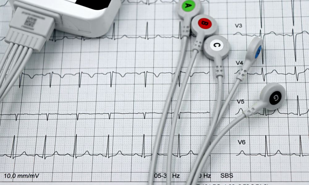 Importancia de realizarse un electrocardiograma a tiempo