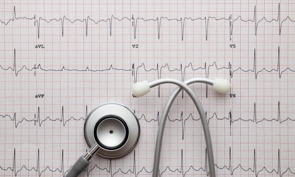 Por qué elegir Clínica Docati para tu electrocardiograma