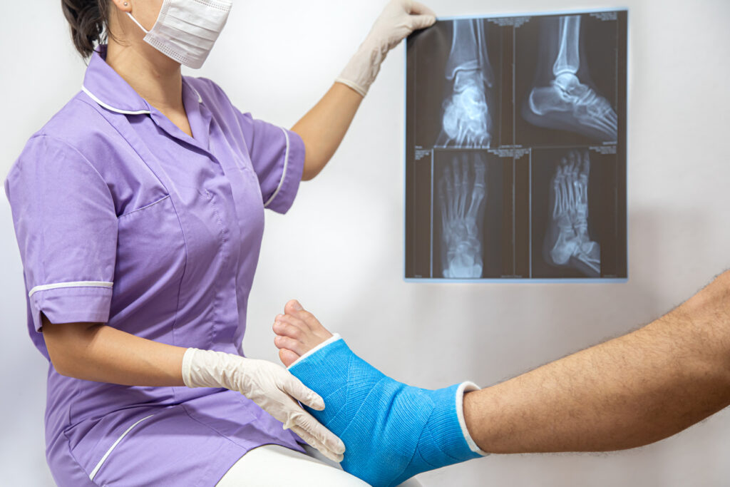 Alternativas avanzadas cuando los rayos X de tobillo no son suficientes