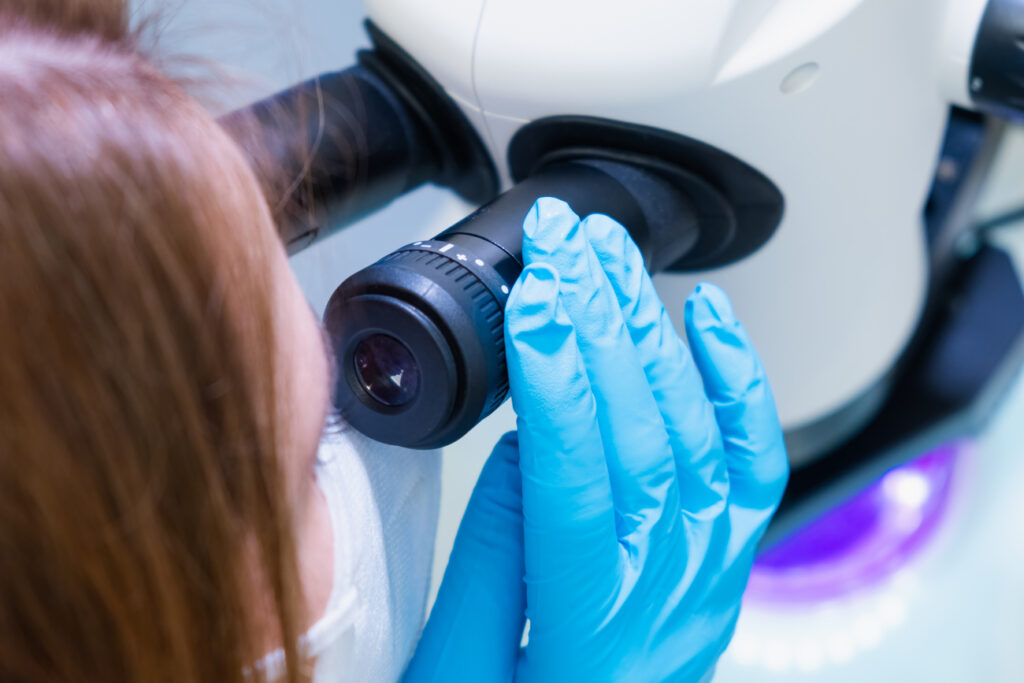 Ventajas de realizar tu biopsia de próstata en Panamá