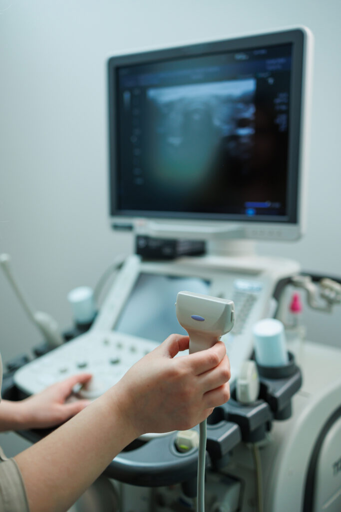 Descubre los Beneficios del Ultrasonido de Bazo para tu Salud