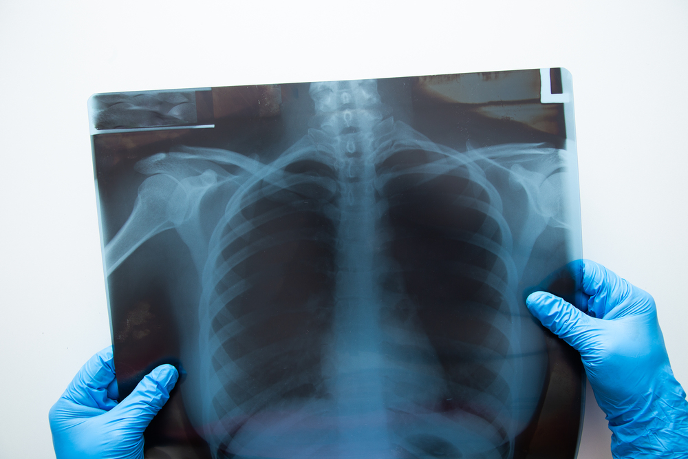 Características Distintivas del Procedimiento