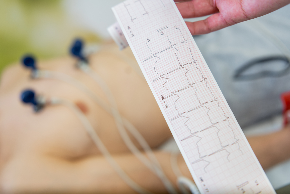 Electrocardiograma Un Vistazo a la Salud del Corazón