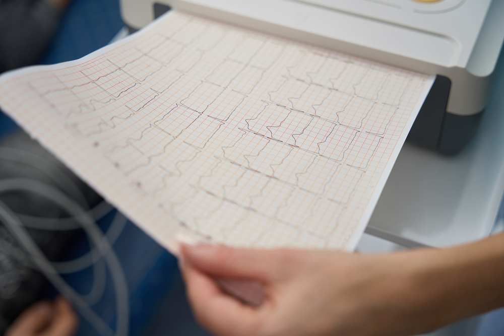 Electrocardiogramas según la Edad