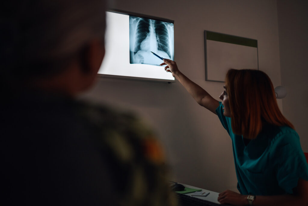 Preparación para una Radiografía de Tórax Guía Práctica