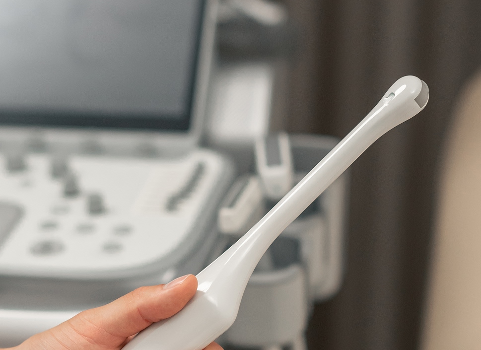 Beneficios del Ultrasonido Transvaginal en la Clínica Docati