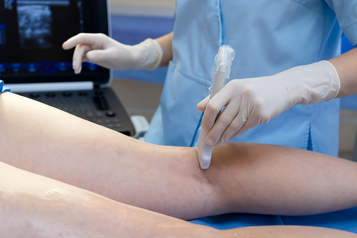 Preparación para Ultrasonido Venoso de TVP Guía del Examen