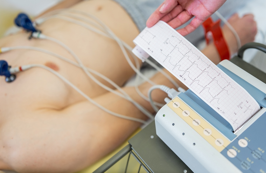 Causas Profundas de un Electrocardiograma Alterado