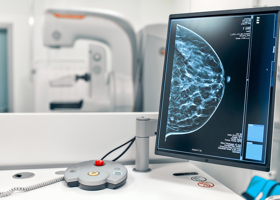 Factores que Modifican la Frecuencia Mamográfica