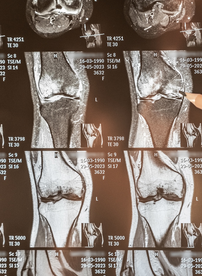 Tipos de radiografía de rodilla que se solicitan con más frecuencia