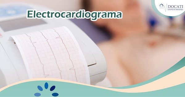 Electrocardiogramas Electrocardiogramas