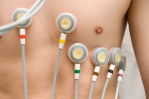 Electrocardiogramas Electrocardiogramas